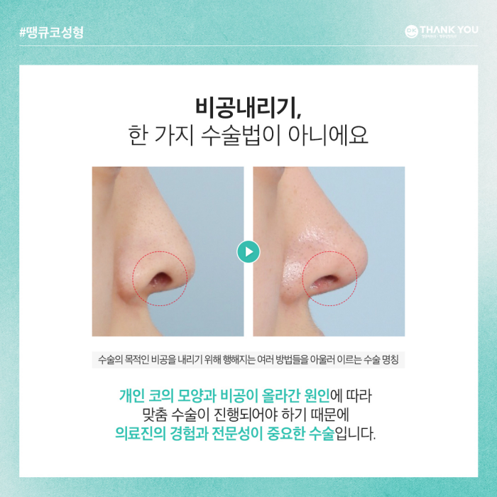 비공내리기로 용코교정하고 조화로운 코 만들기🍀 관련 이미지 4
