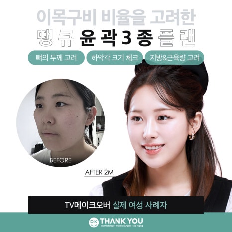 땡큐 윤곽성형 이벤트로 굴곡 없이 작고 매끈한 얼굴 만들기! 관련 이미지 3