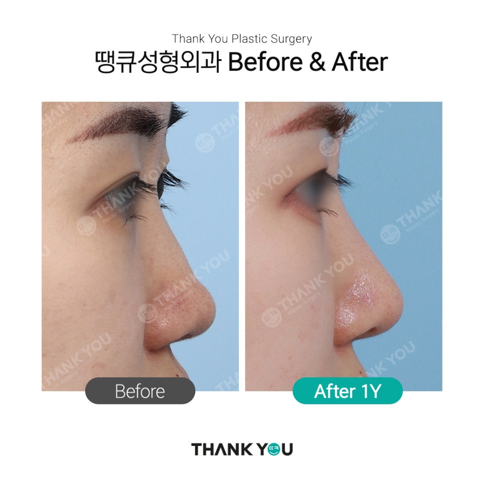 자연스러운 코?직반라인체크+코 비주란? 관련 이미지 2
