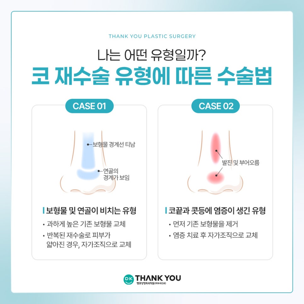 What Does a Contracted Nose Mean, and How Is Revision Surgery Performed? ❓Why Stem Cell Treatment Is Gaining Attention image 9