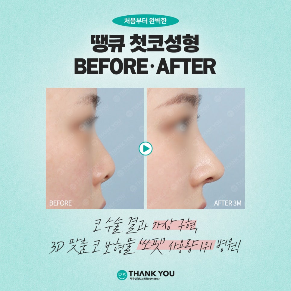 Key Checkpoints You Must Review When Considering Primary Rhinoplasty?! image 9