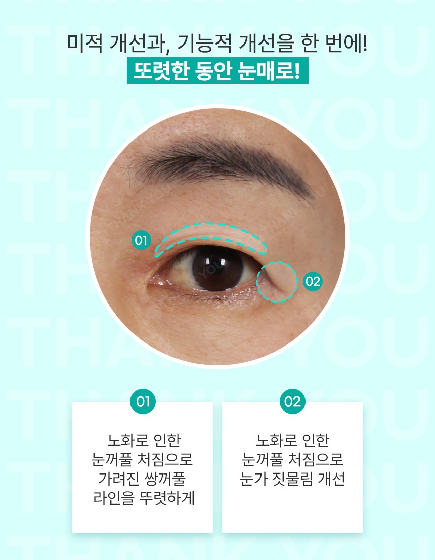 [의학칼럼]노화로 축 처진 눈꺼풀.. 동안 얼굴ㆍ눈 건강 되찾으려면? 관련 이미지 2