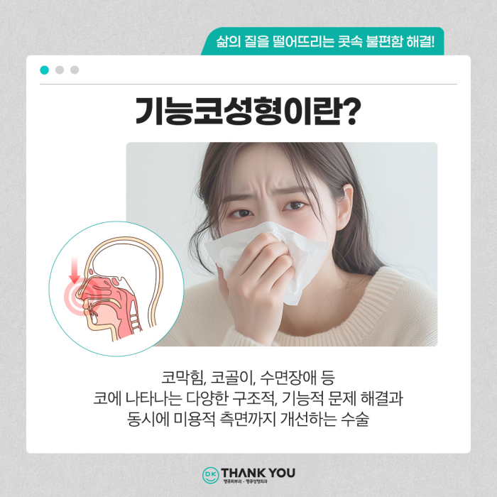 기능코수술병원에서 콧 속 불편함, 외적 스트레스 동시 해소! 관련 이미지 3