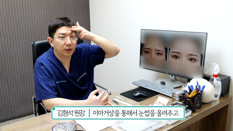 눈재수술 할 때 이마거상 추천하는 이유는? (눈썹올림술 전후) 관련 이미지 16