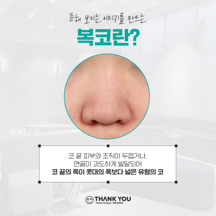 복코성형, 꼭 코뼈절골을 해야할까요? 관련 이미지 2