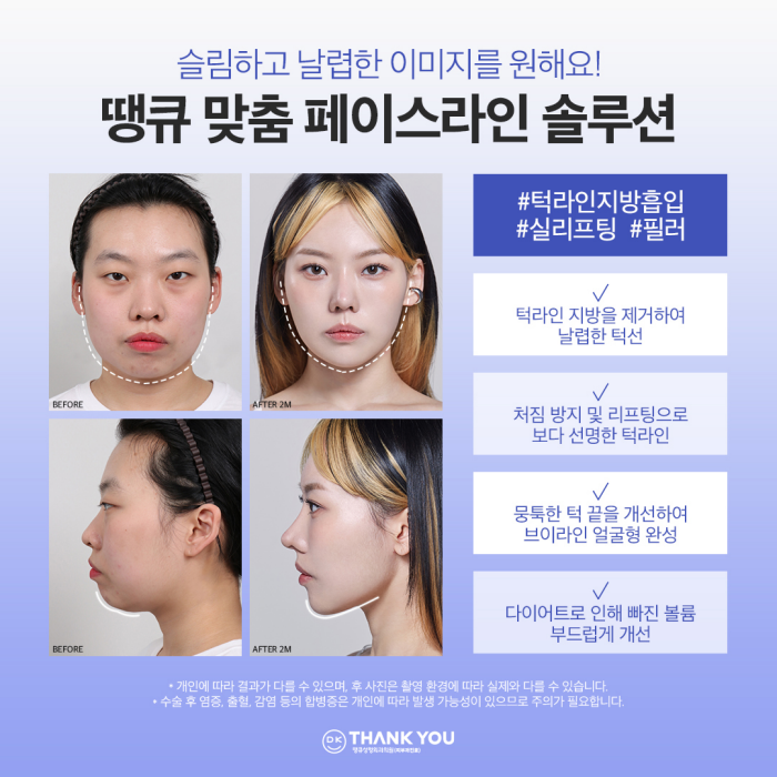 Create a Harmonious Face with Improved Face Line! Complete a Line That Suits Your Features⭐ image 2