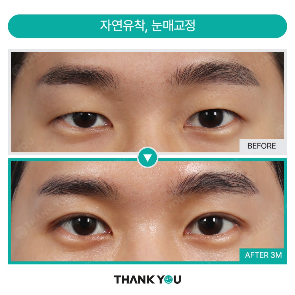 가로로 긴 눈은 어떤 쌍꺼풀라인이 어울릴까요? 관련 이미지 11