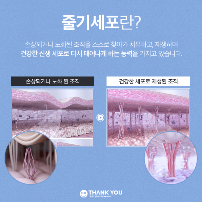 땡큐 줄기세포 피부주사 효과로 손상된 피부 리셋! 관련 이미지 3