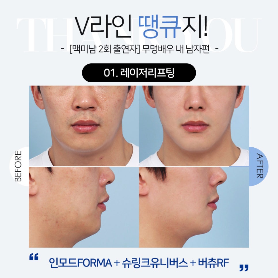 맥미남 기우쌤도 극찬한 땡큐 무명배우(남자 피부관리&리프팅) 관련 이미지 3