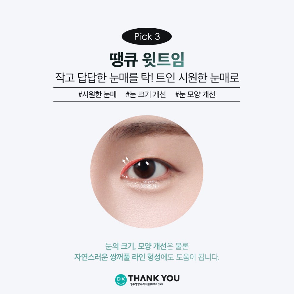 Thank You’s Exam Taker Event at a Great Place for Eye Surgery! ✨Triple Eye Surgery✨ image 6