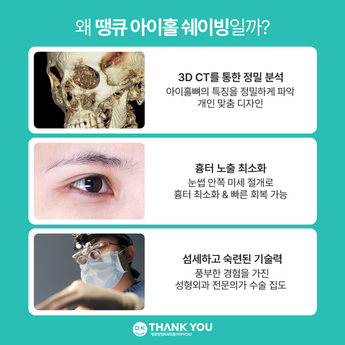 눈매개선, 눈성형으로 해결되지 않는다면?! 눈의 틀을 개선하는 아이홀쉐이빙 관련 이미지 5