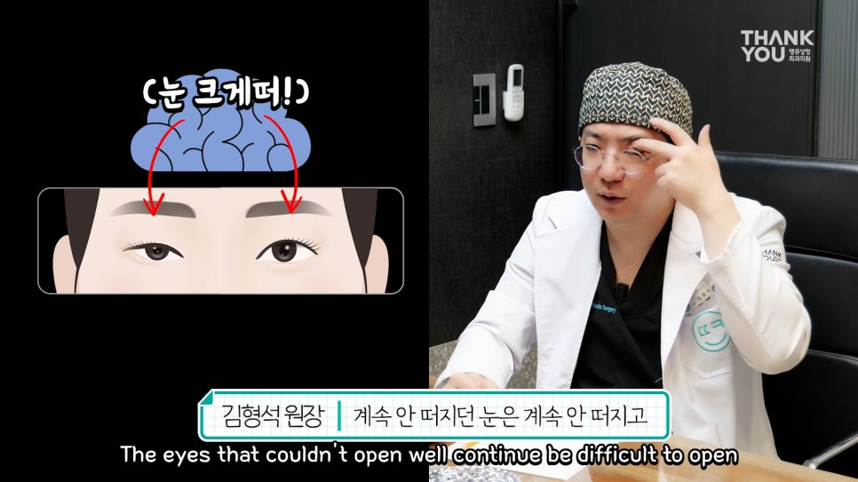 비대칭눈 교정(짝짝이 쌍꺼풀) 헤링의 법칙이란? 관련 이미지 7