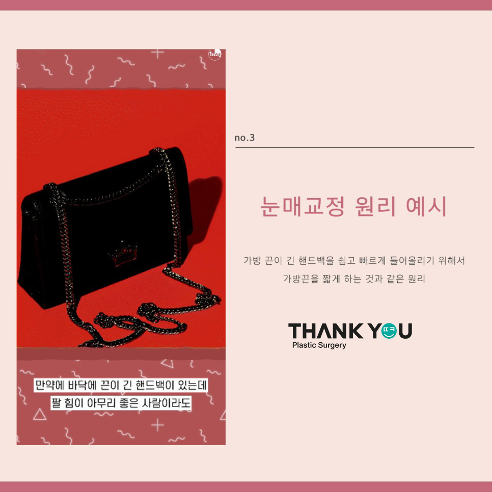땡큐성형외과, 쌍수 눈매교정? 안검하수 유무 관련 이미지 4