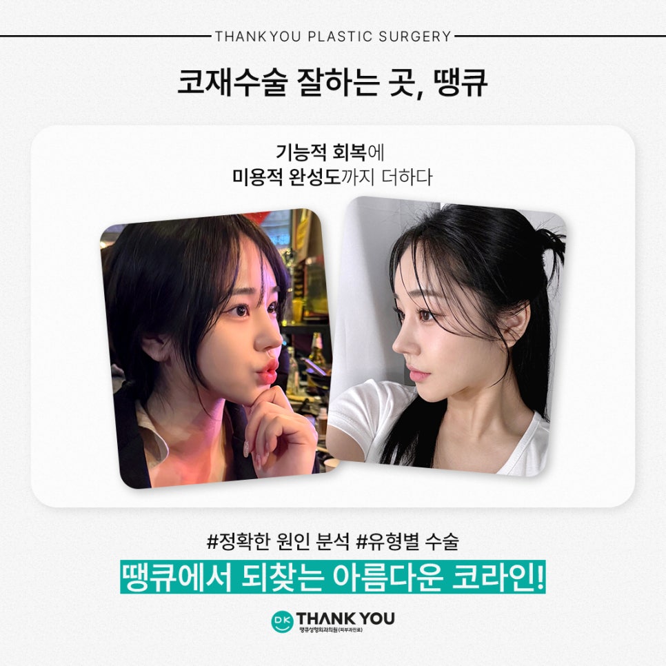 코재수술잘하는곳 땡큐가 제안하는 유형별 수술 방법은? 관련 이미지 9