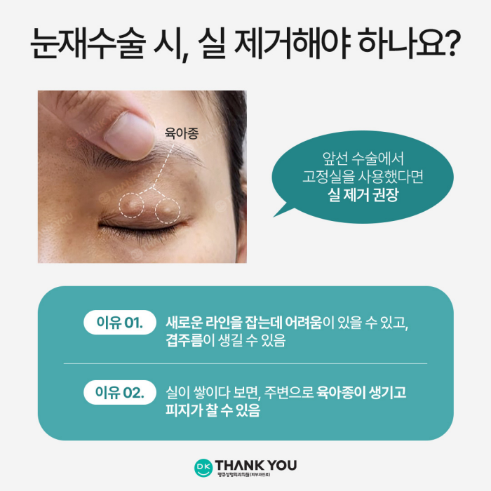 Selection Criteria for Incisional or Non-Incisional Surgery, as Explained by a Specialist in Revision Eyelid Surgery image 5