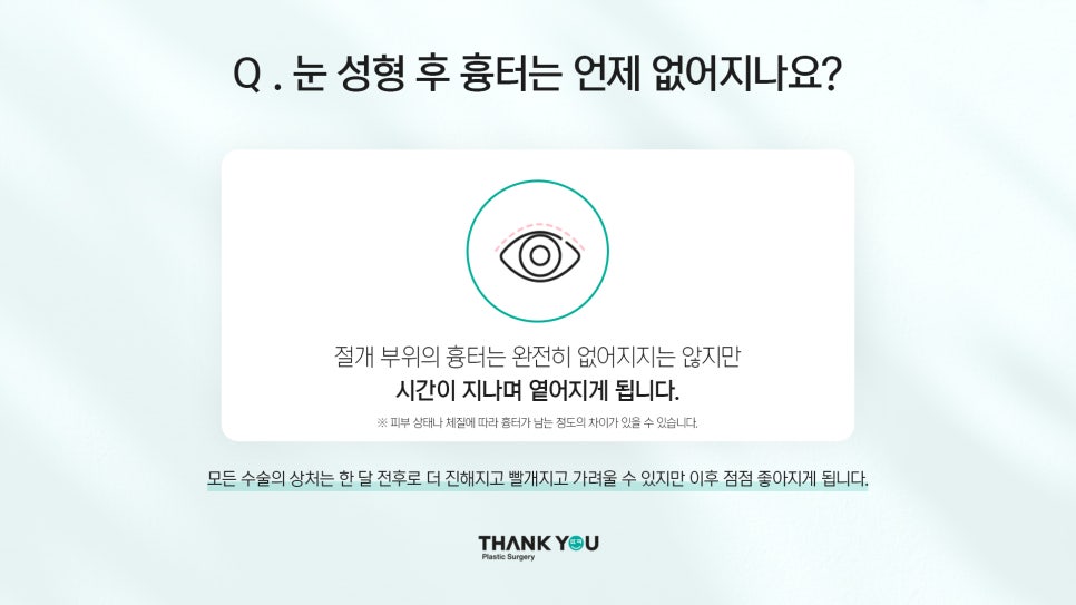 쌍수후 주의사항? 렌즈 껴도 되나요? 관련 이미지 11