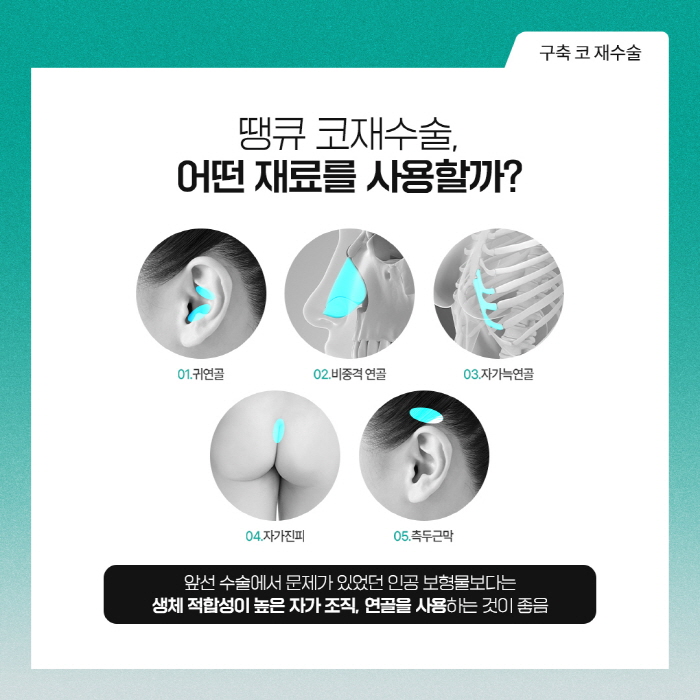 구축코재수술 개인 상태에 따른 계획이 중요해요 관련 이미지 6