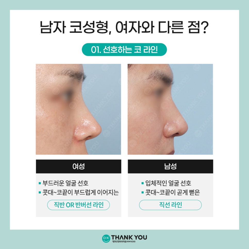 [남자코수술 전후] 코성형외과는 왜 땡큐일까?! 관련 이미지 2