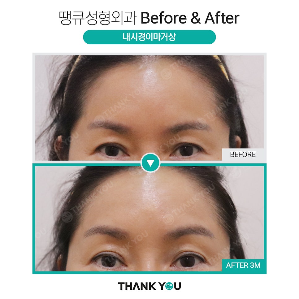 눈가 주름까지 개선하는 이마거상 관련 이미지 11