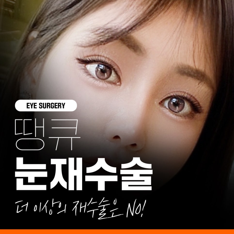 강남 눈재수술, THANK YOU기존 쌍꺼풀라인 풀기 관련 이미지 1