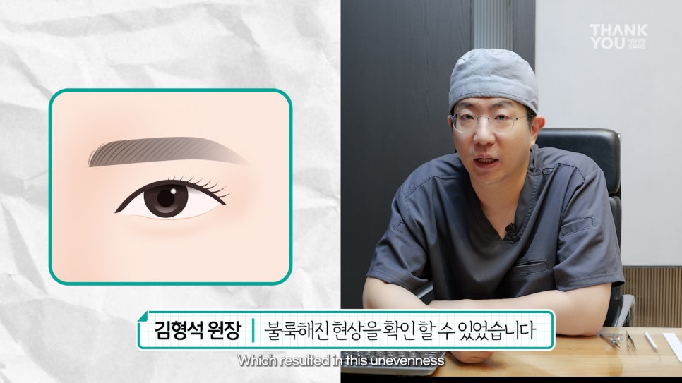 쌍수에 눈썹올림술을 추천하는 이유?! 관련 이미지 15