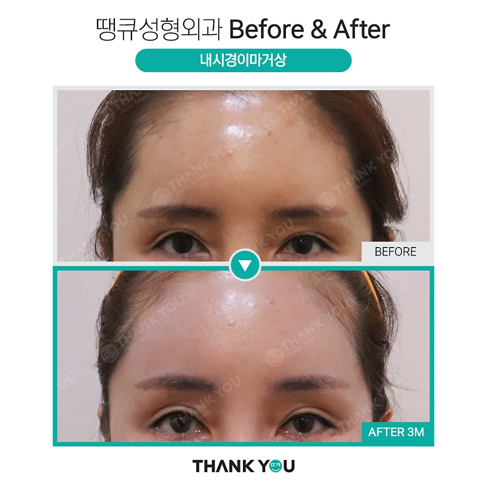 눈가 주름까지 개선하는 이마거상 관련 이미지 8
