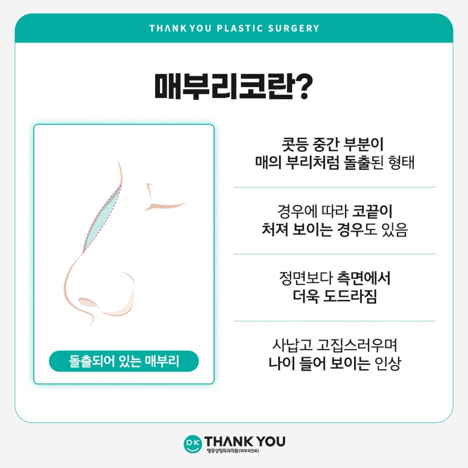 매부리코개선, 돌출 정도에 따른 맞춤 수술이 중요! 관련 이미지 2