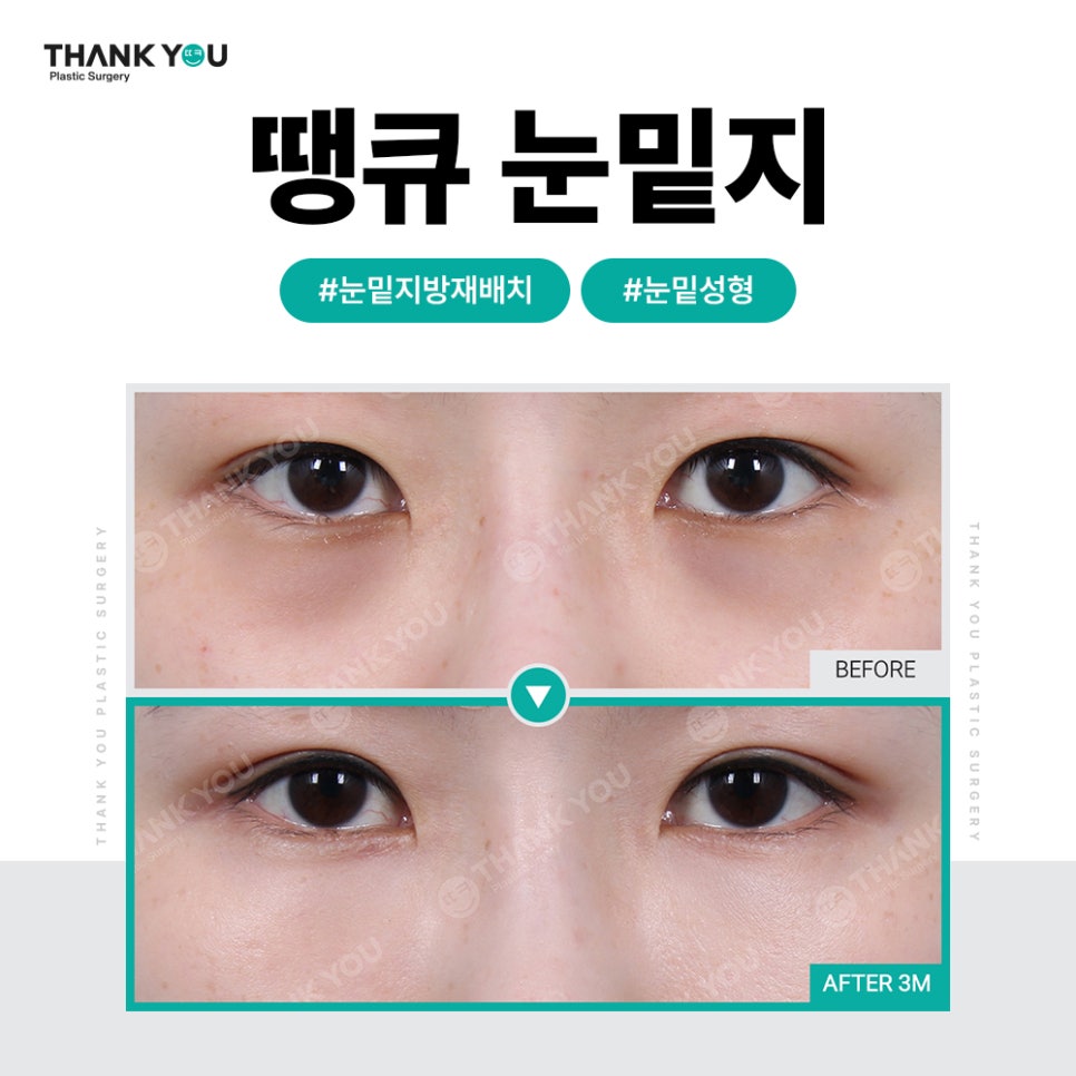 화려한 눈 가능?! 인아웃라인 김세정 쌍꺼풀처럼 관련 이미지 26