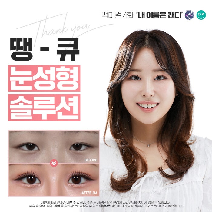 Thank You Plastic Surgery, a Hospital Skilled in Eye Surgery! Providing Customized Solutions for a Make Me Girl Case Study😉 image 1