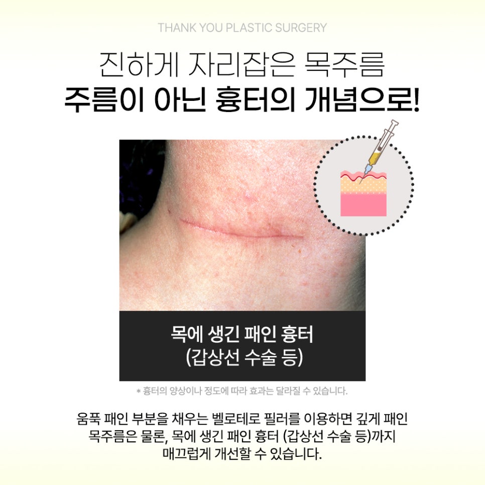 땡큐피부과 목주름 필러 EVENT ✨ 관련 이미지 3