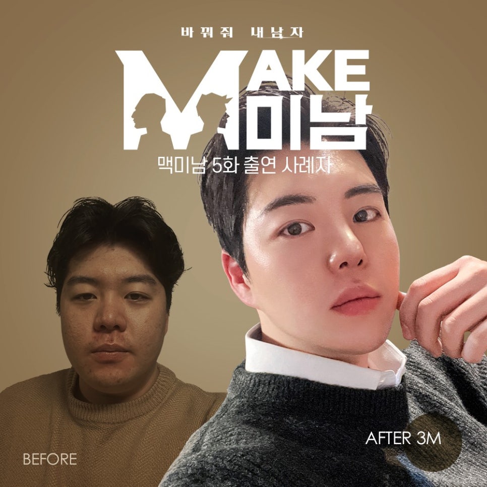 땡큐 맥미남, 뮤지컬배우 남자 복부지방흡입 전후 Check 관련 이미지 1