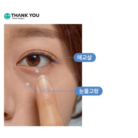 눈밑수술, 눈밑지방이식도 가능한가요? 관련 이미지 2