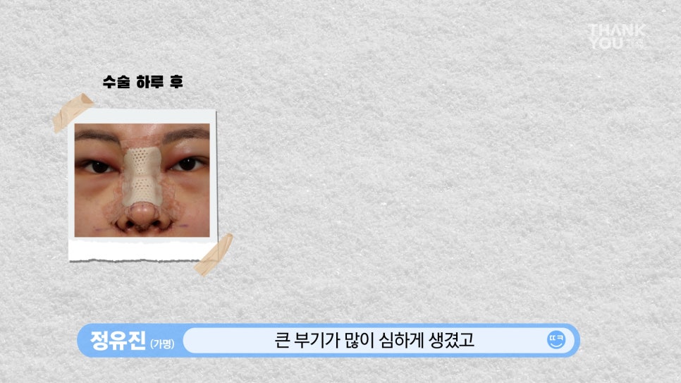 뚱뚱한 코 탈출! 실리콘 코성형👃(직원 코성형 브이로그2탄) 관련 이미지 11