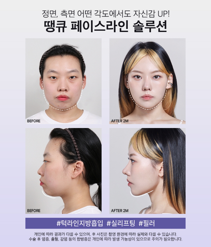 맥미걸 관련 이미지 5