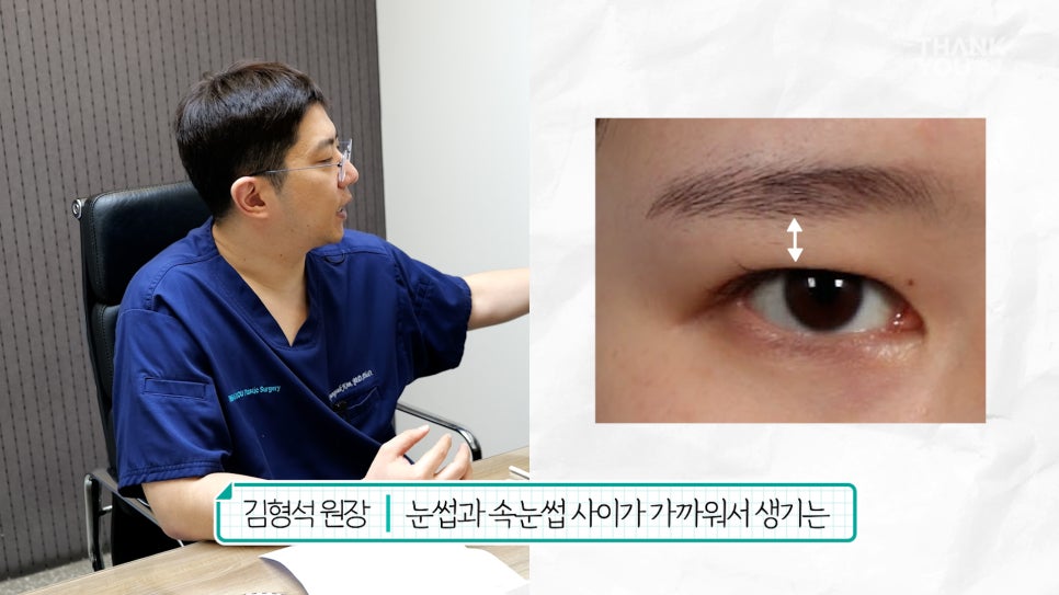 눈재수술 할 때 이마거상 추천하는 이유는? (눈썹올림술 전후) 관련 이미지 13