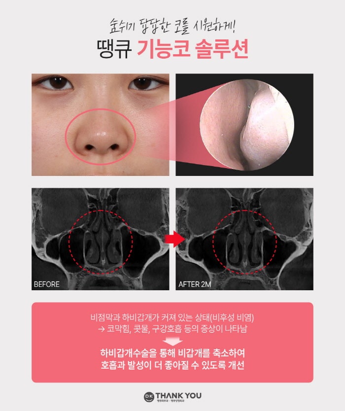 맥미걸 관련 이미지 3