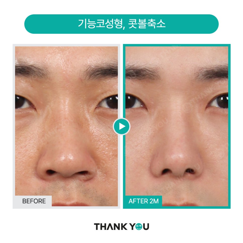 맥미남 배우, 확 달라진 변화? 남자성형외과는 THANK YOU! 관련 이미지 14