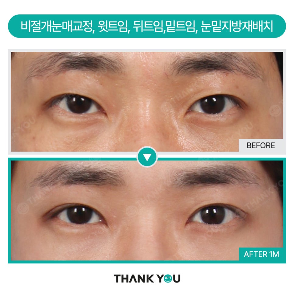 맥미남 배우, 확 달라진 변화? 남자성형외과는 THANK YOU! 관련 이미지 11