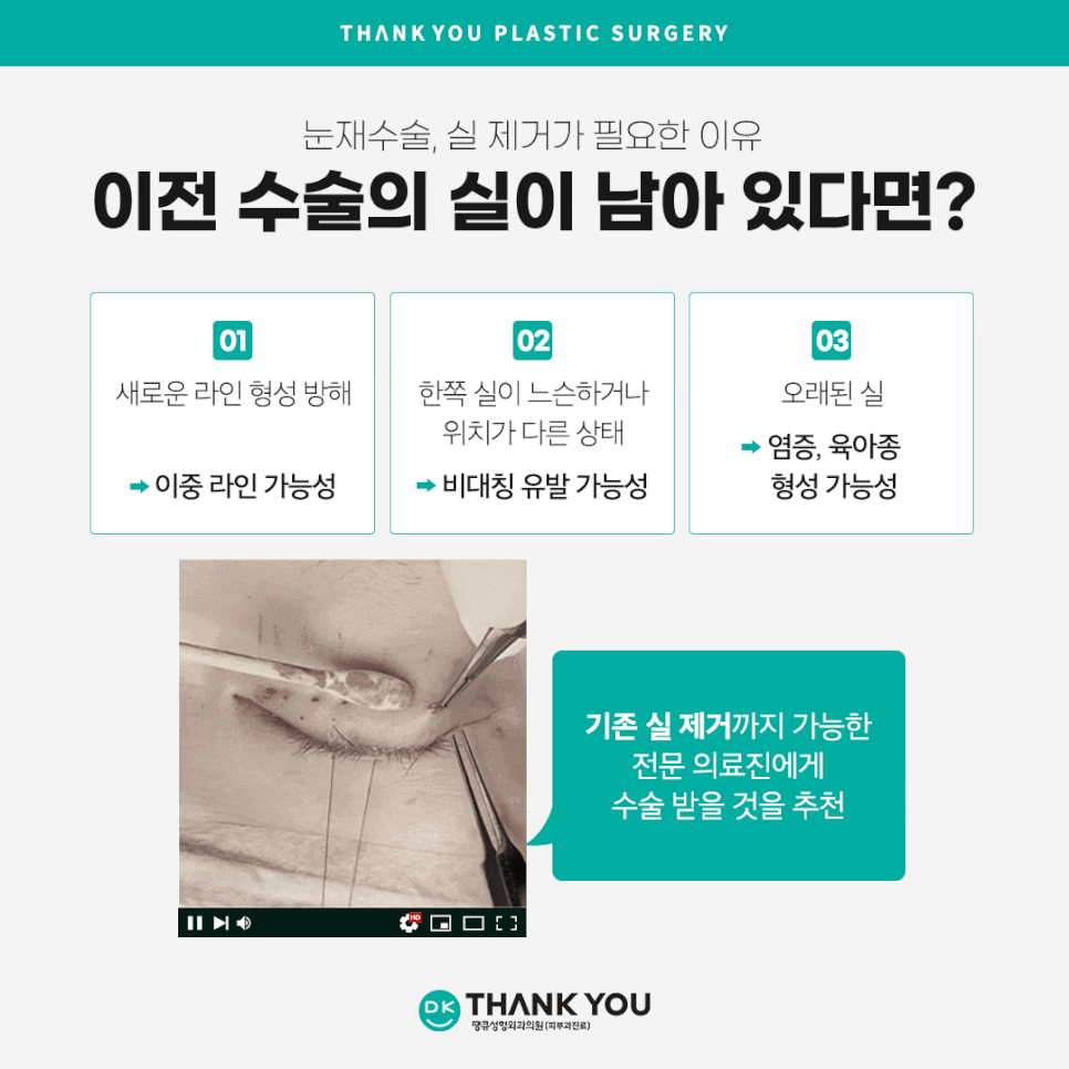 눈재수술병원 선택 시 신중해야 하는 이유는?! 관련 이미지 7