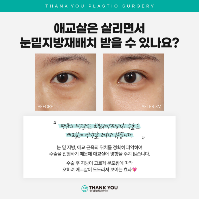 Recommended Under-Eye Fat Repositioning! Transform Your Look to Be Brighter and More Vibrant! image 7