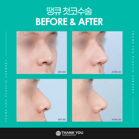 첫코수술 성공을 위해 고려해야 할 점은? 관련 이미지 11