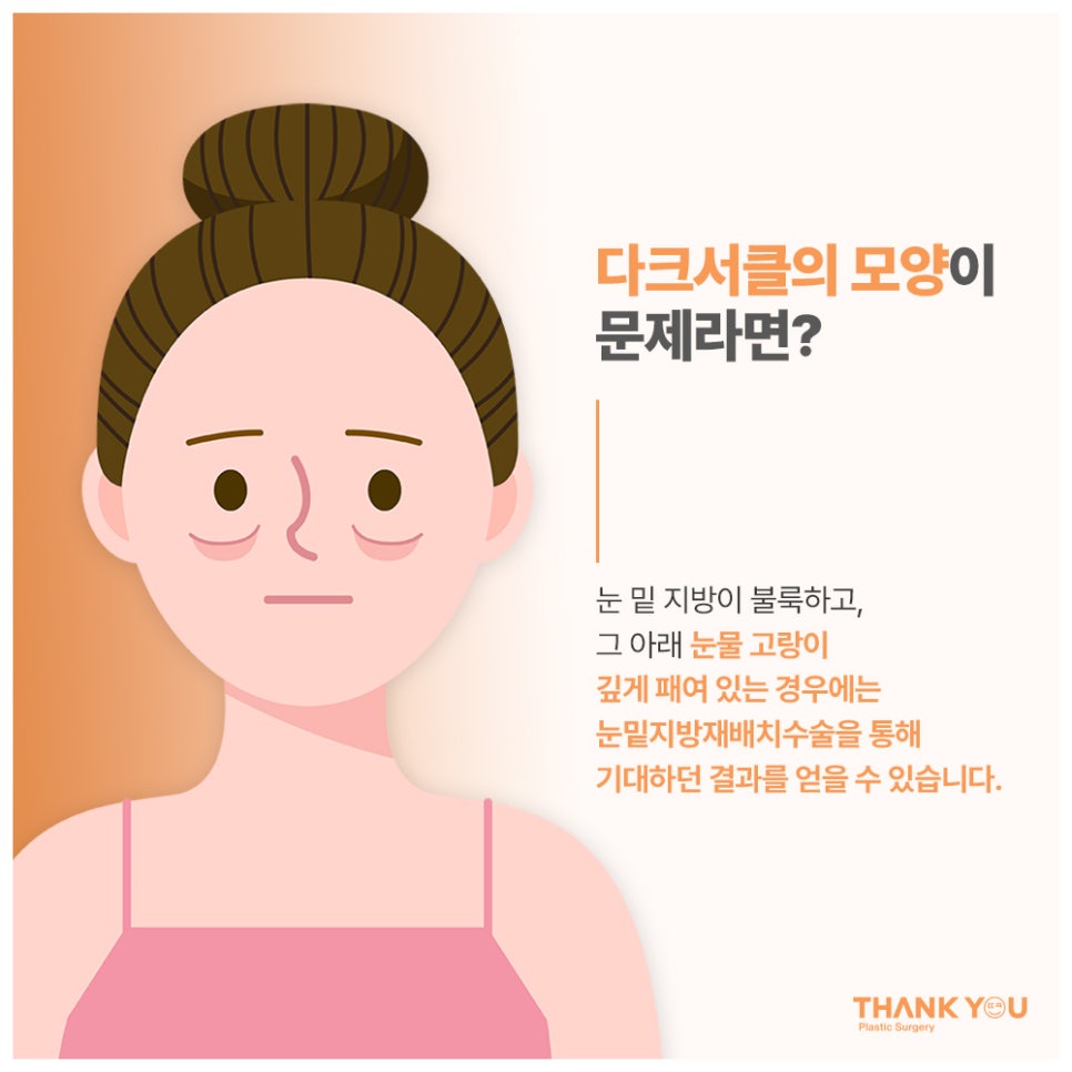 다크서클 눈밑지방재배치 수술로 개선될까? 관련 이미지 6