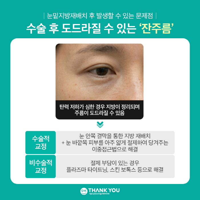 눈밑지방재배치 부작용 어떤 것들이 있을까? 관련 이미지 3