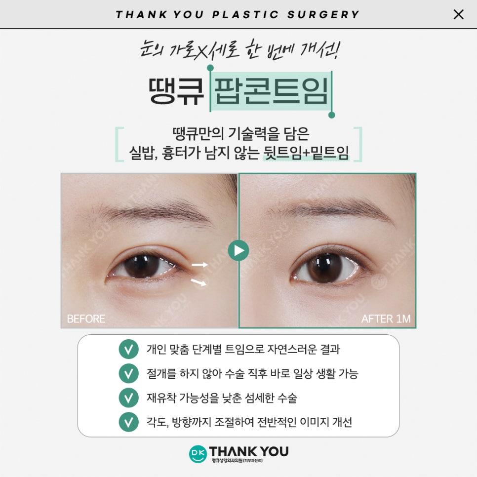 듀얼트임효과로 답답한 꼬막눈을 시원하게! 관련 이미지 7