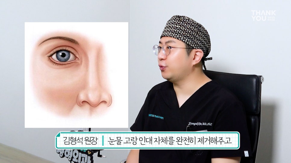 연예인 눈밑지방재배치?경결막과 눈물고랑이란? 관련 이미지 10