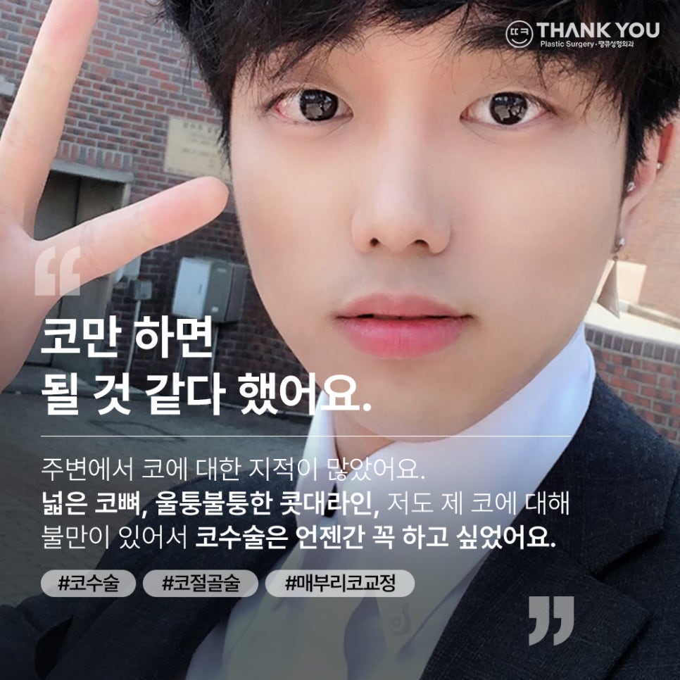 남자코성형후기, 코절골술로 매부리코를 매끈하게 관련 이미지 1