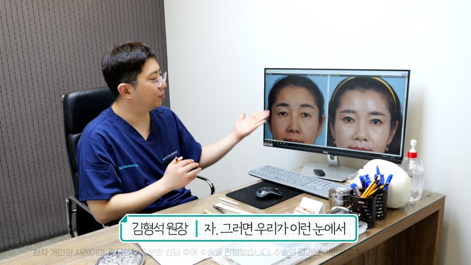 중년눈성형 전후& 이마거상+눈썹하거상+쌍수로 젊어지기 관련 이미지 11