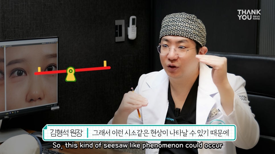 비대칭눈 교정(짝짝이 쌍꺼풀) 헤링의 법칙이란? 관련 이미지 17