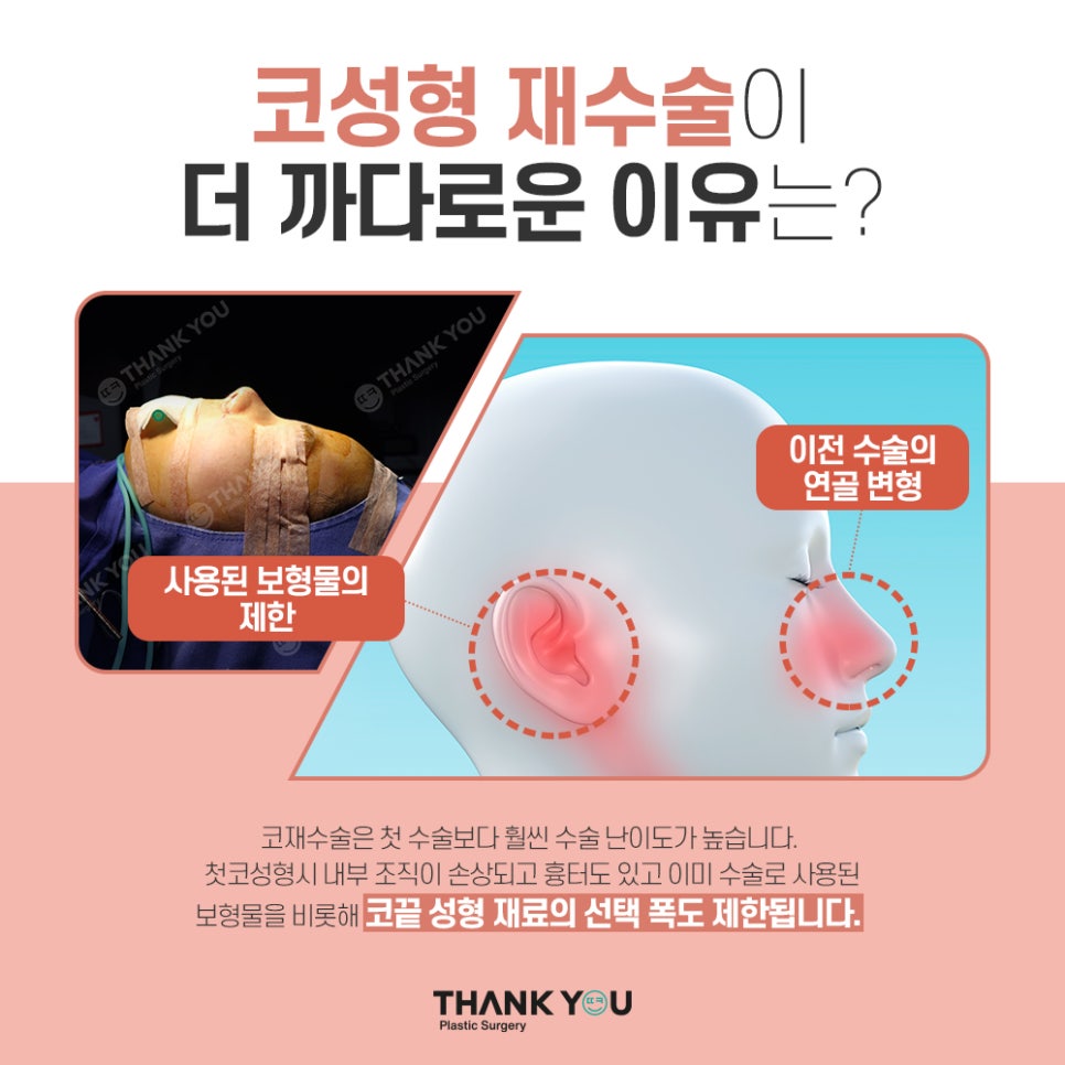 코성형 재수술 비용이 더 비싼 이유는?(수술이 더 어려운 이유) 관련 이미지 4