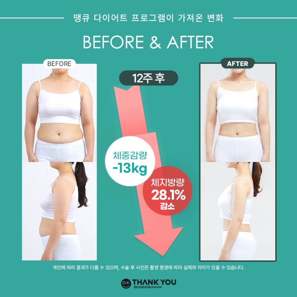 Diet Injection Effect? The Advantages of Each GLP-1 Injection Type Are Right Here! image 8